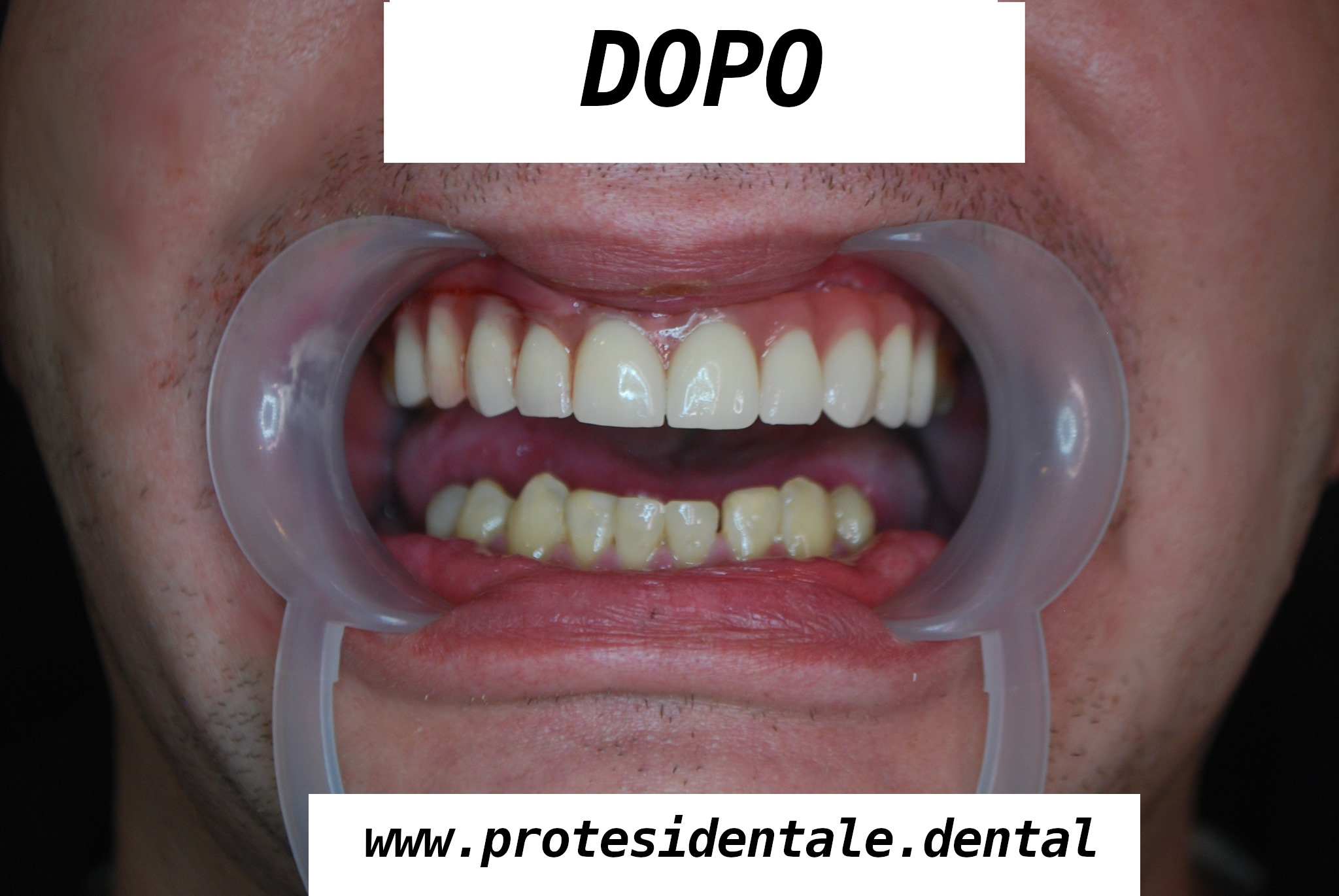 zdj po