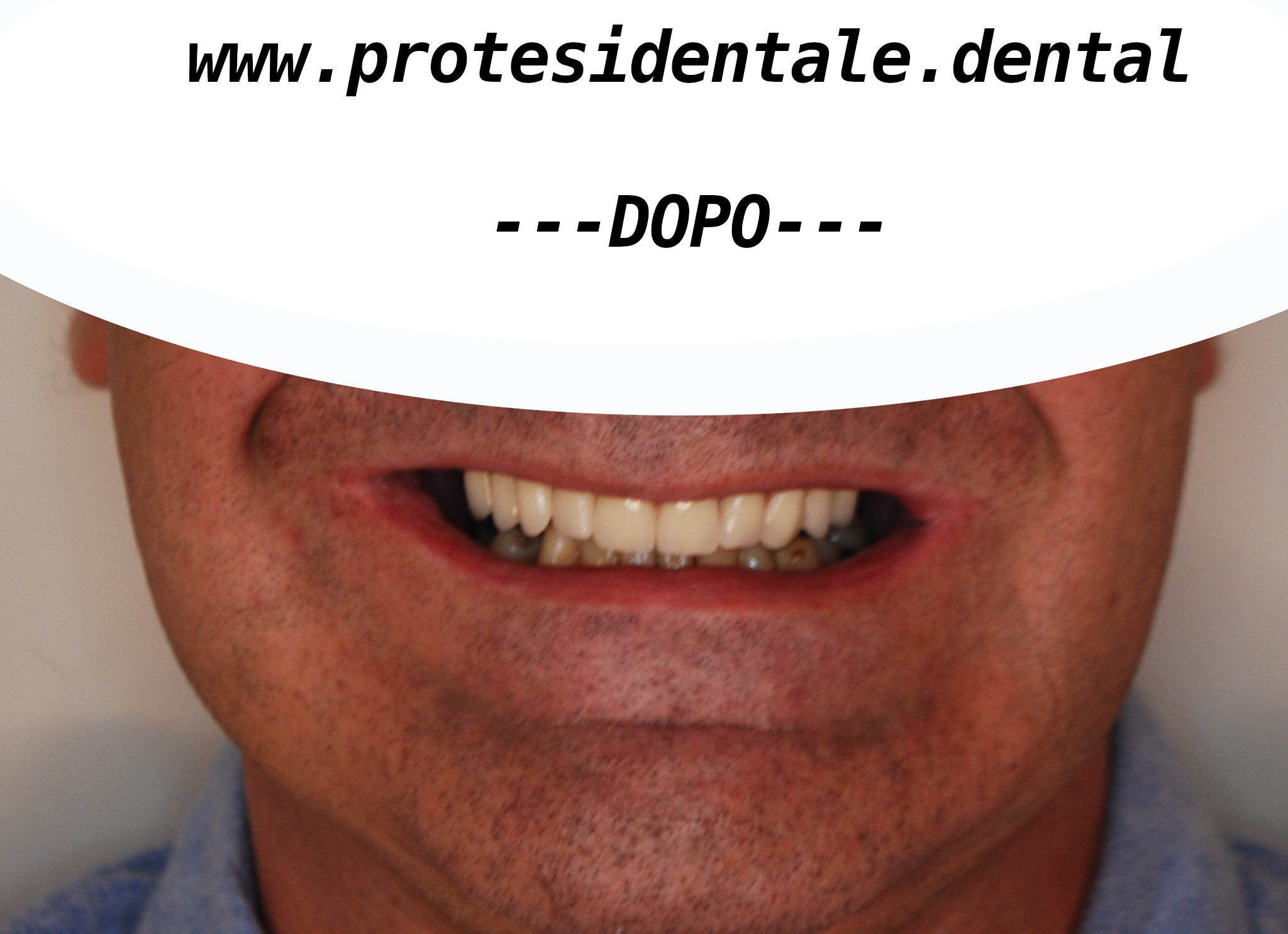 zdj po