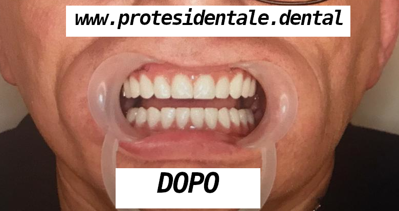 zdj po